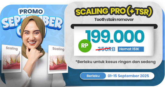 Scaling gigi PRO (+TSR)